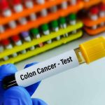 Gloved hand holding colon cancer test tube