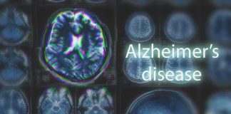 MRI brain scan highlighting Alzheimer's disease