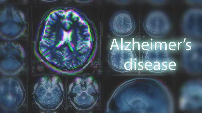 shutterstock_1054068035 (2).jpg MRI brain scan highlighting Alzheimer's disease