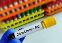 Gloved hand holding colon cancer test tube