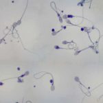 Microscopic image showing various sperm cells in a biological sample