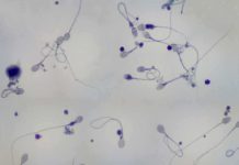 Microscopic image showing various sperm cells in a biological sample