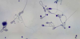 Microscopic image showing various sperm cells in a biological sample