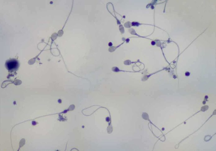 Microscopic image showing various sperm cells in a biological sample