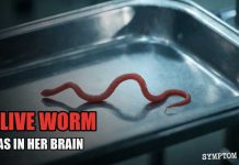 She ate Wild Greens. One Year Later, They Pulled A Live Worm From Her Brain.