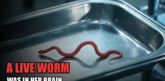 She ate Wild Greens. One Year Later, They Pulled A Live Worm From Her Brain.