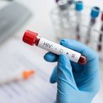 Controversial AIDS-Era Ban Coming Back Gloved hand holding a blood sample tube labeled for HIV test