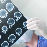 Doctor holding brain MRI scans