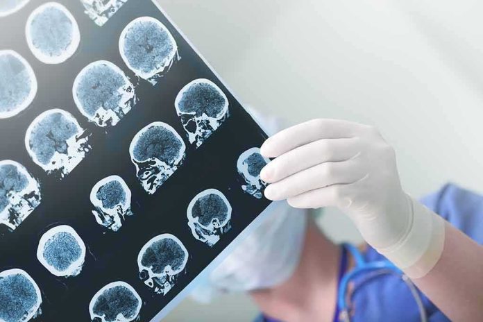 Doctor holding brain MRI scans